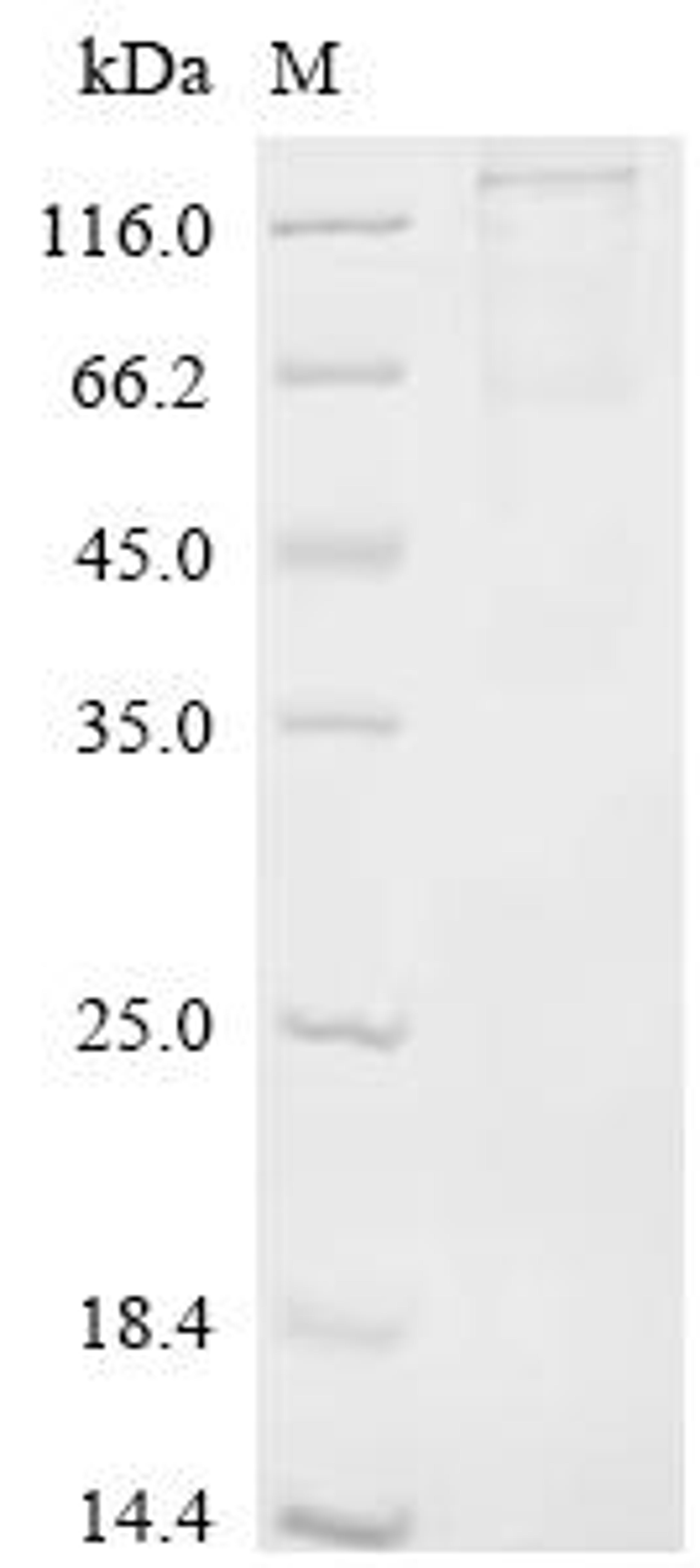 (Tris-Glycine gel) Discontinuous SDS-PAGE (reduced) with 5% enrichment gel and 15% separation gel.