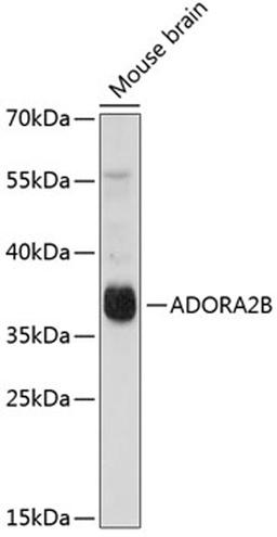 Western blot - ADORA2B antibody (A1953)