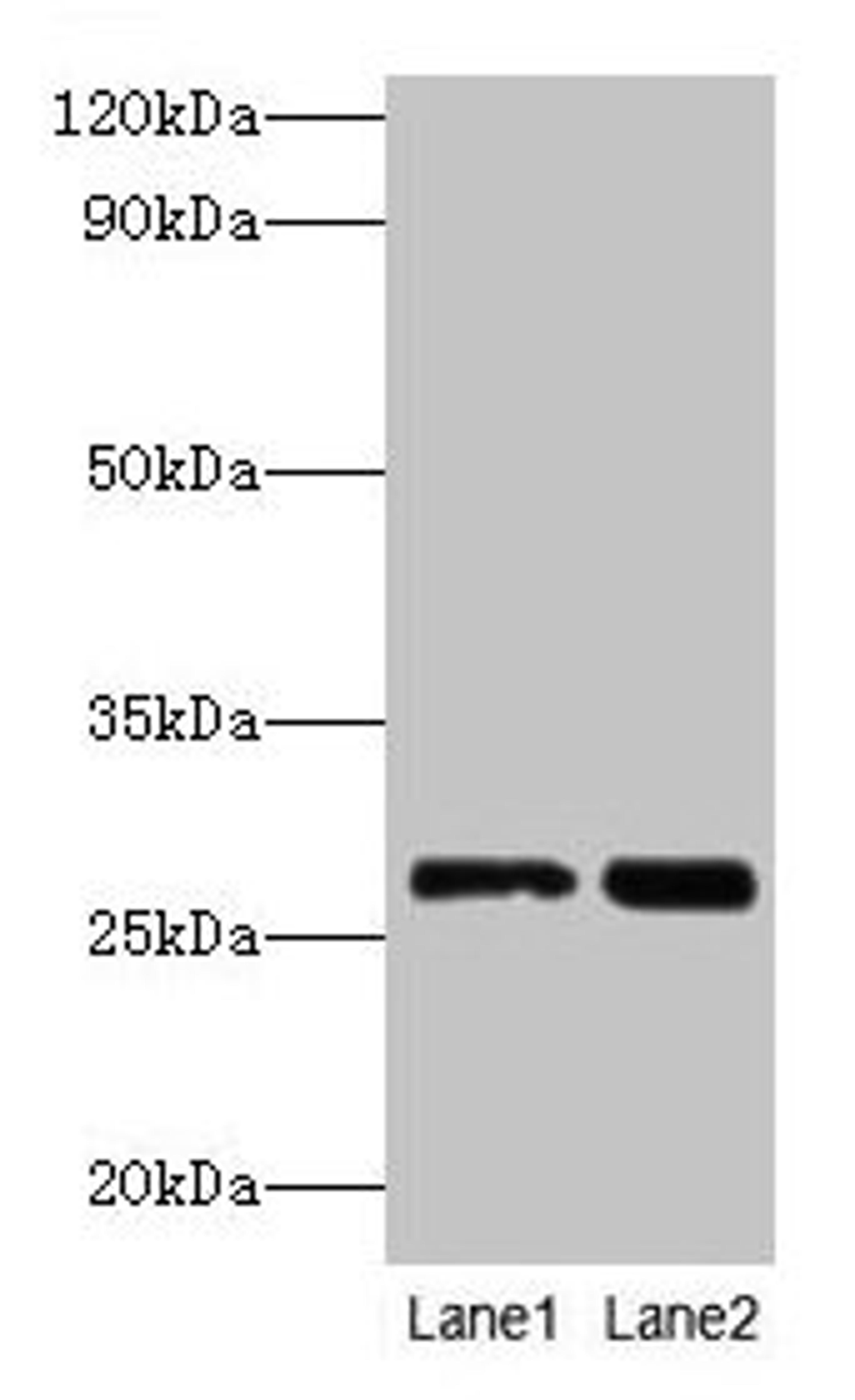 Western blot. All lanes: LGALS3 antibody at 2µg/ml. Lane 1: Hela whole cell lysate. Lane 2: MCF-7 whole cell lysate. Secondary. Goat polyclonal to rabbit IgG at 1/10000 dilution. Predicted band size: 27 kDa. Observed band size: 27 kDa