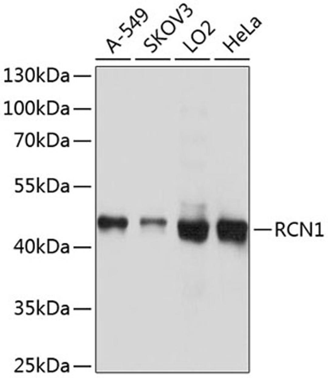 Western blot - RCN1 antibody (A10572)