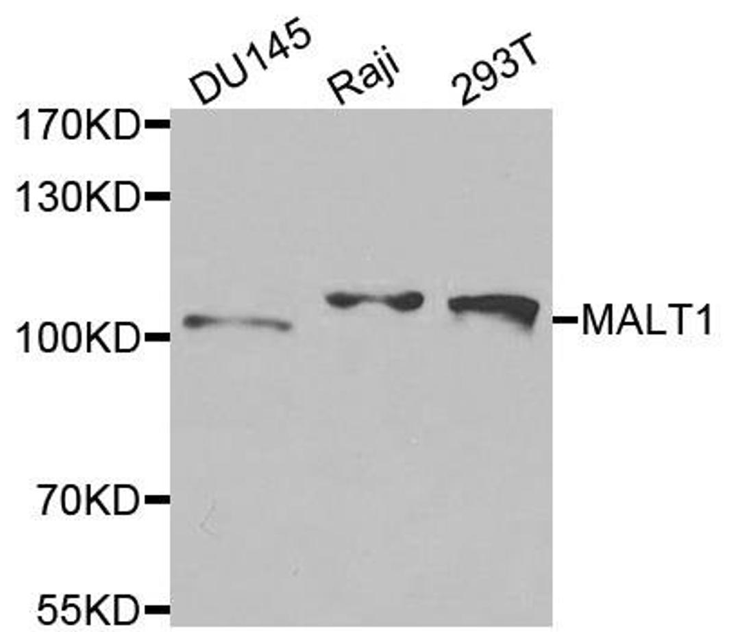 Western blot analysis of extracts of various cells using MALT1 antibody