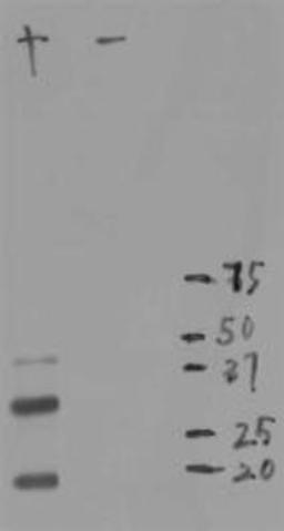 Western Blot: mCherry Antibody (1C51) [NBP1-96752] - WB assay of the crude extract of Hek293 cells transfected with pFin-EF1-mCherry vector (lane +) and  an equal amount of protein extract from untransfected Hek293 cells (lane -). NBP1-96752 binds a major band running at about 28kDa corresponding to intact full-length mCherry. The two other bands are clearly processed forms of mCherry as they are not present in non-transfected Hek293 cells.