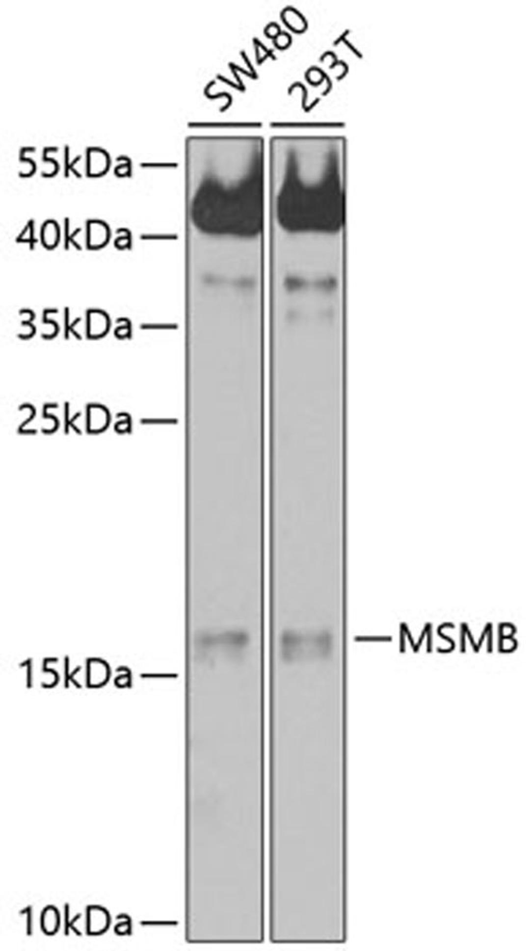 Western blot - MSMB antibody (A10092)