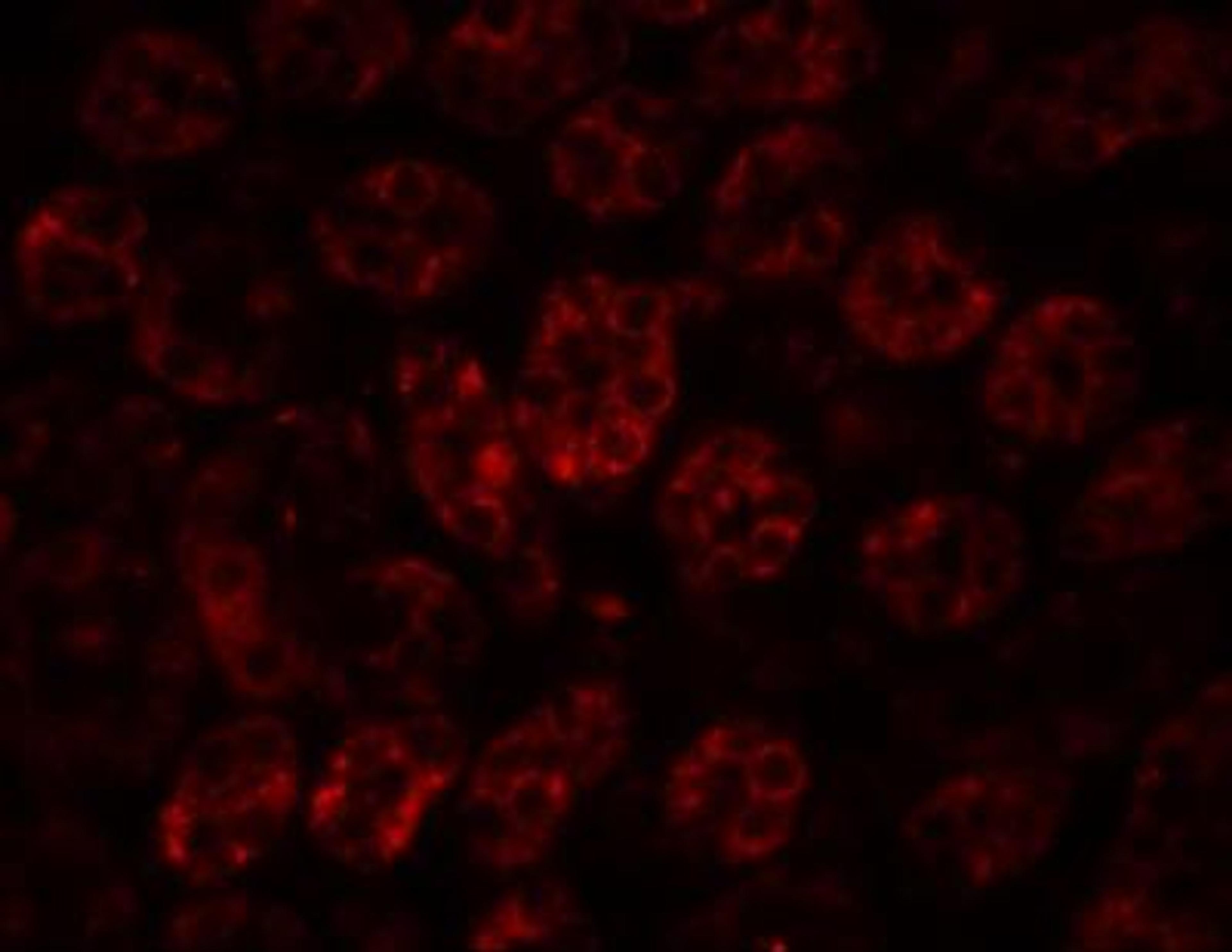 Immunocytochemistry/Immunofluorescence: ENC1 Antibody [NBP1-77146] - Immunofluorescence of ENC-1 in rat kidney tissue with ENC-1 antibody at 20 ug/mL.