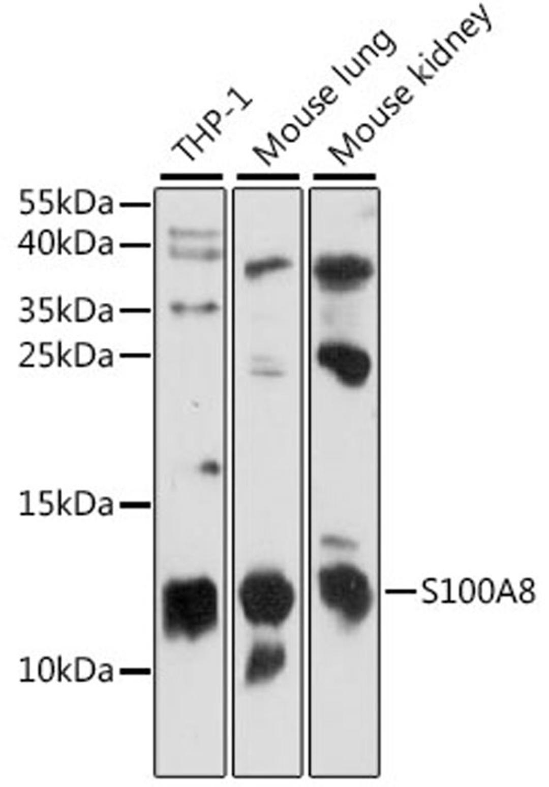 Western blot - S100A8 antibody (A15315)