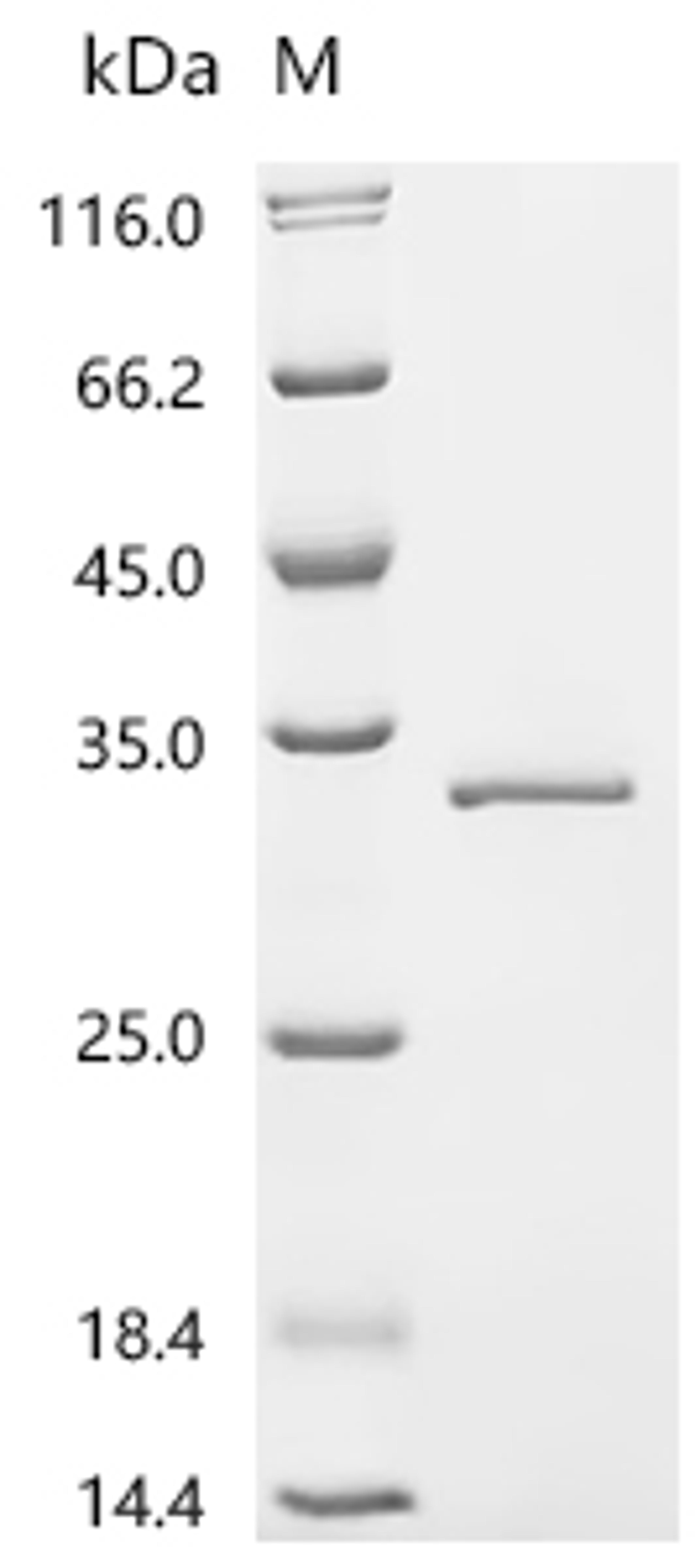 (Tris-Glycine gel) Discontinuous SDS-PAGE (reduced) with 5% enrichment gel and 15% separation gel.