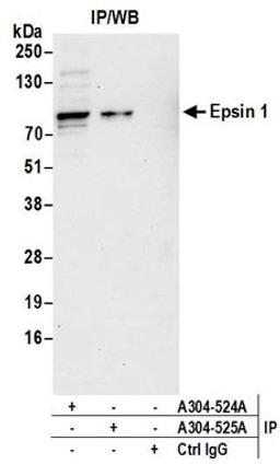 Detection of human Epsin 1 by western blot of immunoprecipitates.