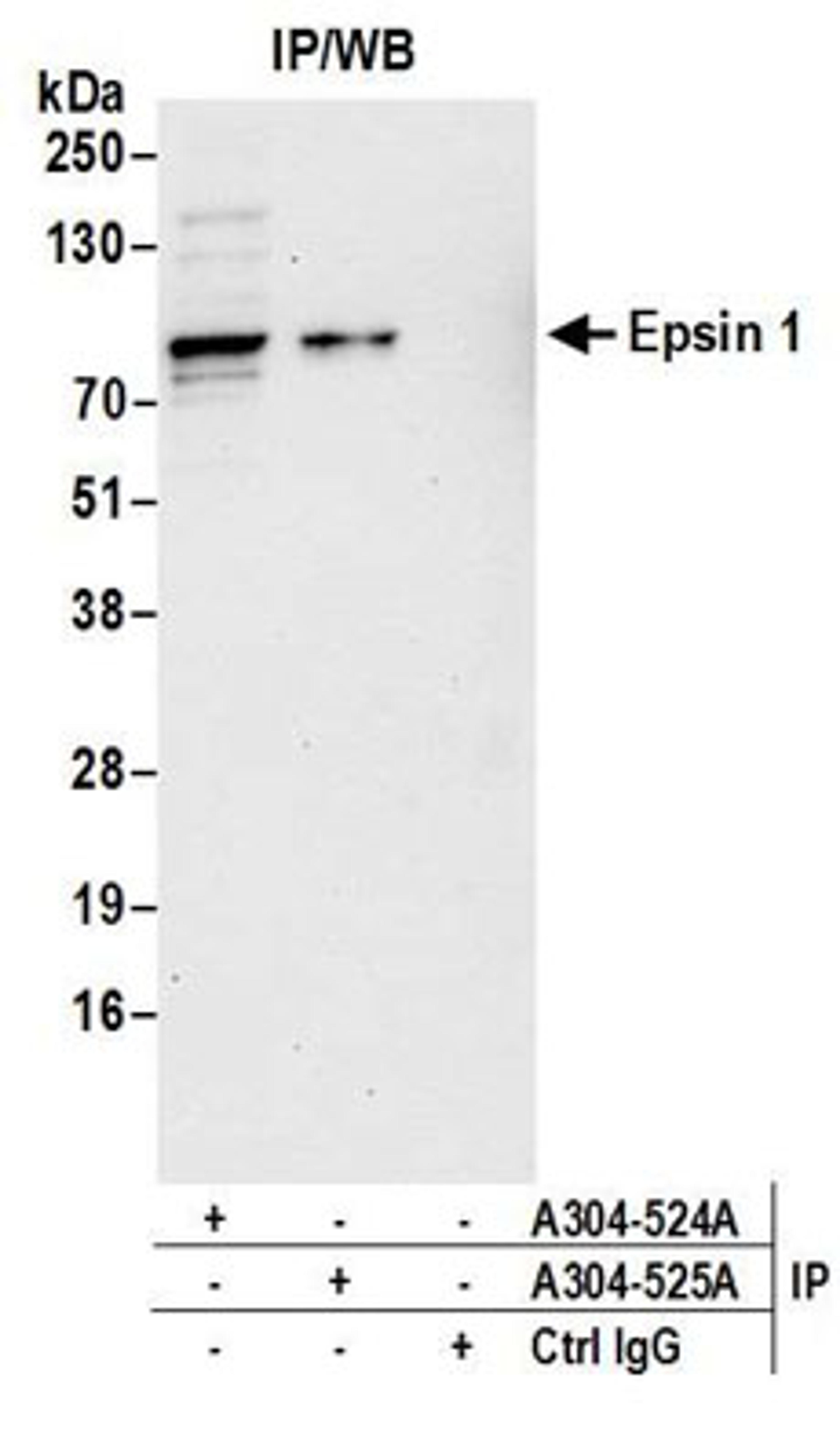 Detection of human Epsin 1 by western blot of immunoprecipitates.