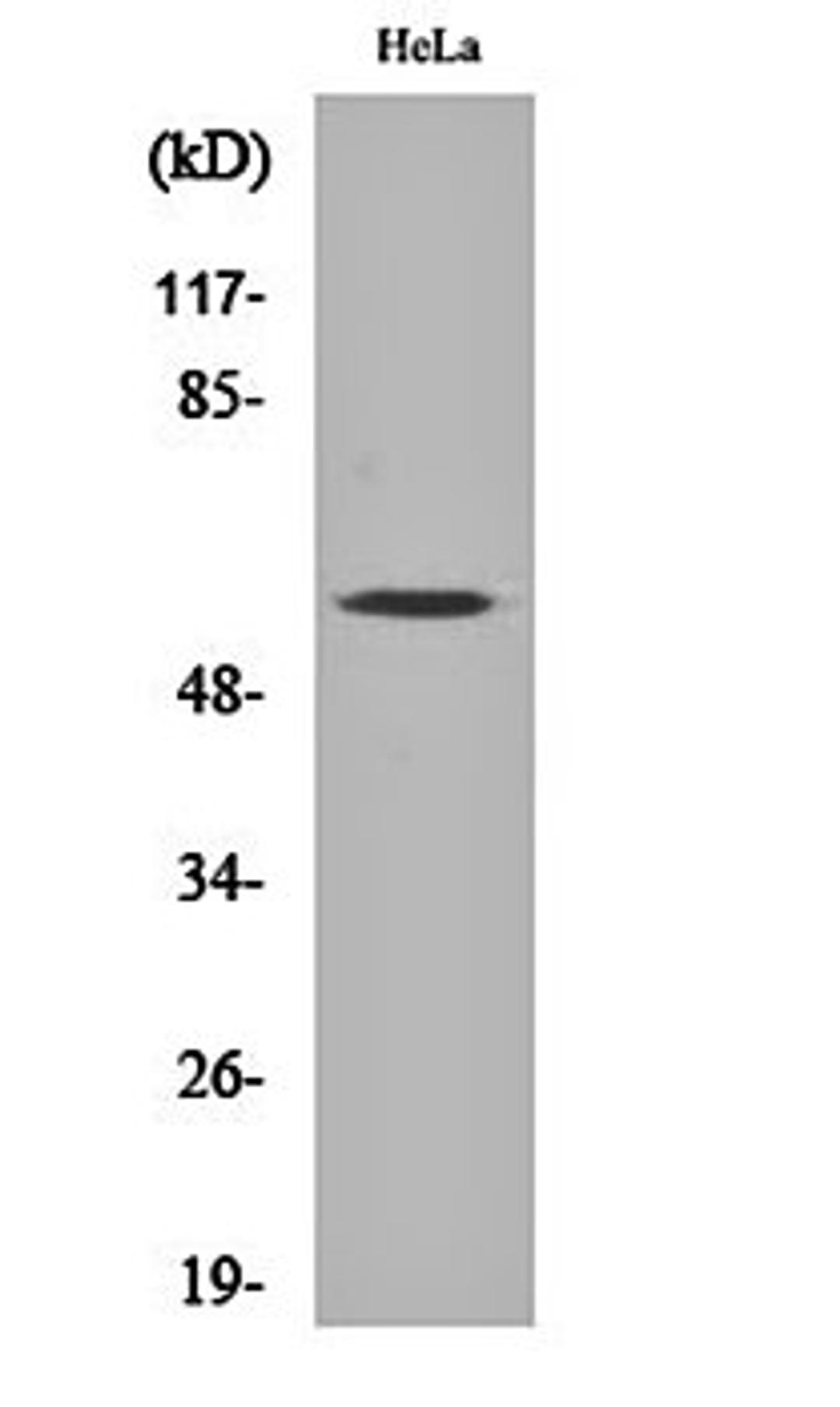 Western blot analysis of Hela cell lysates using MYH antibody