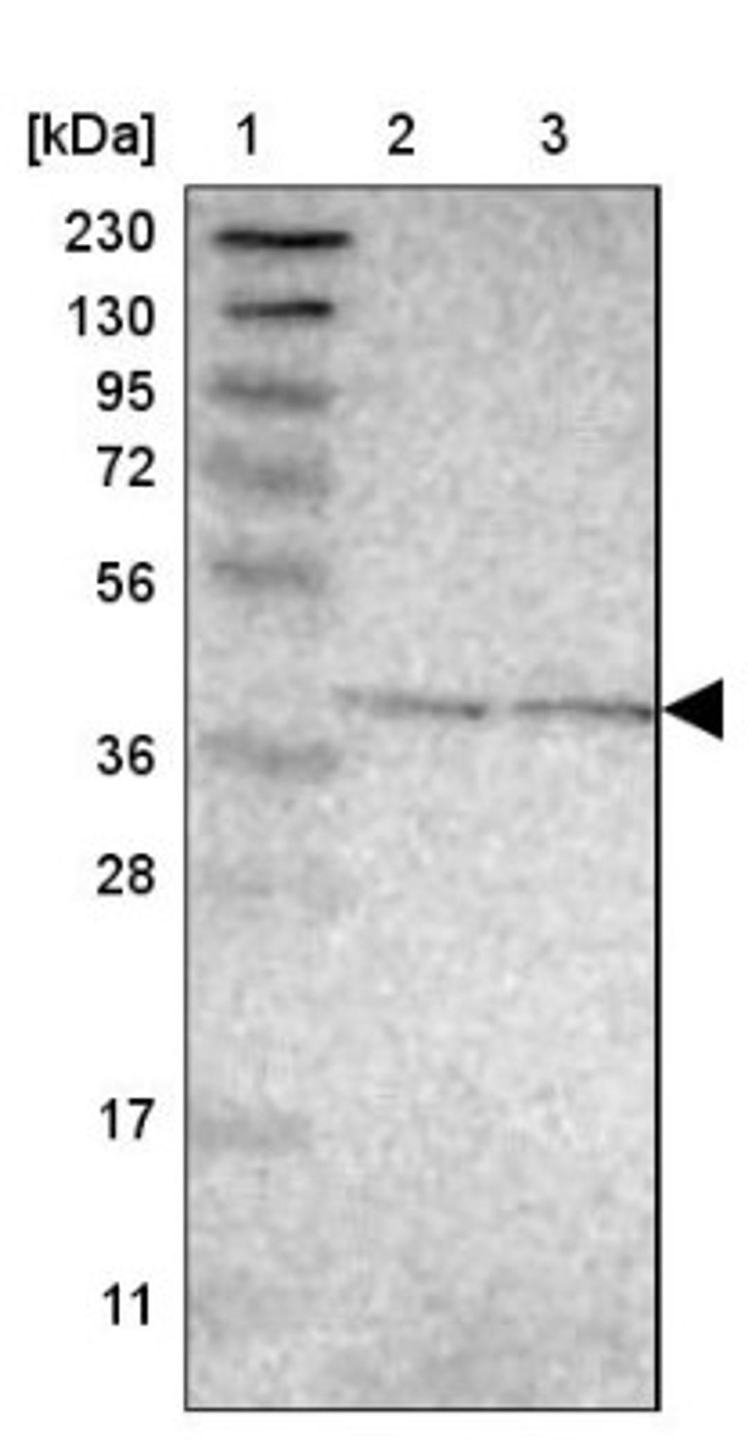 Western Blot: C6orf72 Antibody [NBP1-84240] - Lane 1: Marker [kDa] 230, 130, 95, 72, 56, 36, 28, 17, 11<br/>Lane 2: Human cell line RT-4<br/>Lane 3: Human cell line U-251MG sp