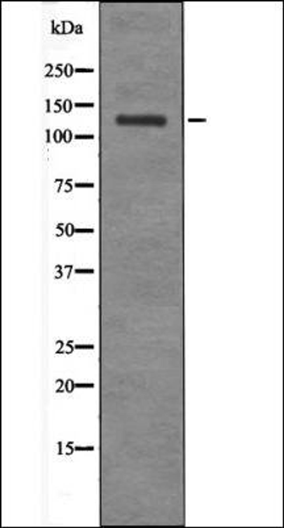 Western blot analysis of EGF treated HepG2 whole cell lysates using JAK2/3 -Phospho-Tyr966/939- antibody