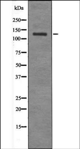 Western blot analysis of EGF treated HepG2 whole cell lysates using JAK2/3 -Phospho-Tyr966/939- antibody