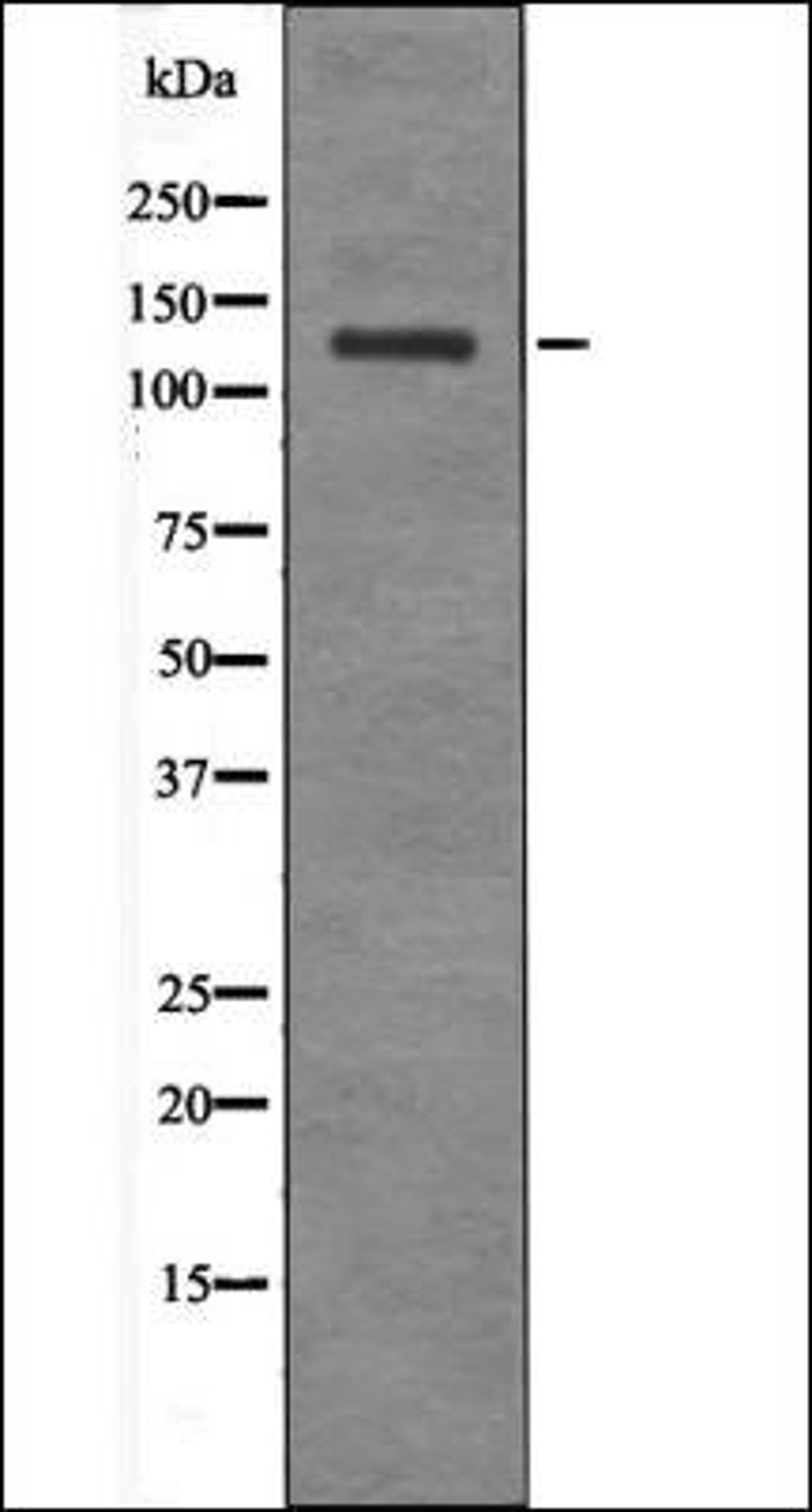 Western blot analysis of EGF treated HepG2 whole cell lysates using JAK2/3 -Phospho-Tyr966/939- antibody