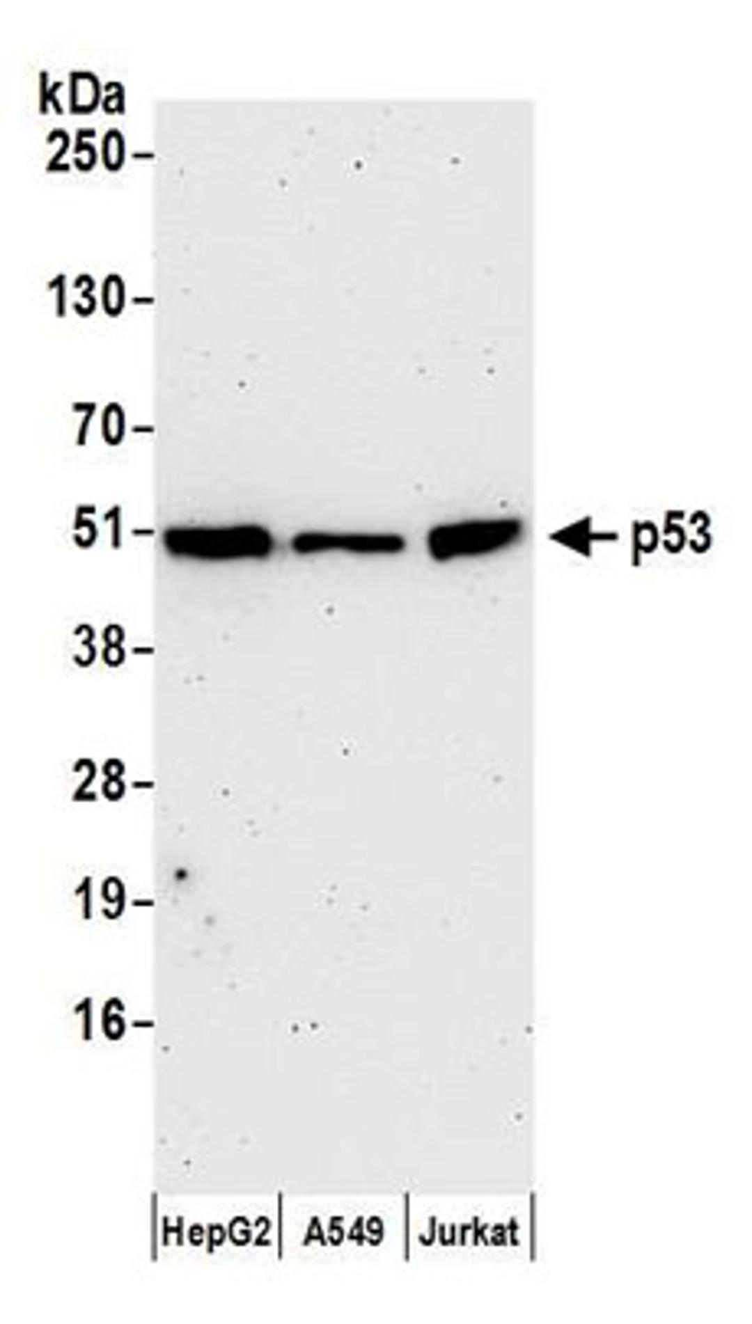 Detection of human p53 by western blot.