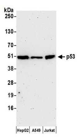 Detection of human p53 by western blot.