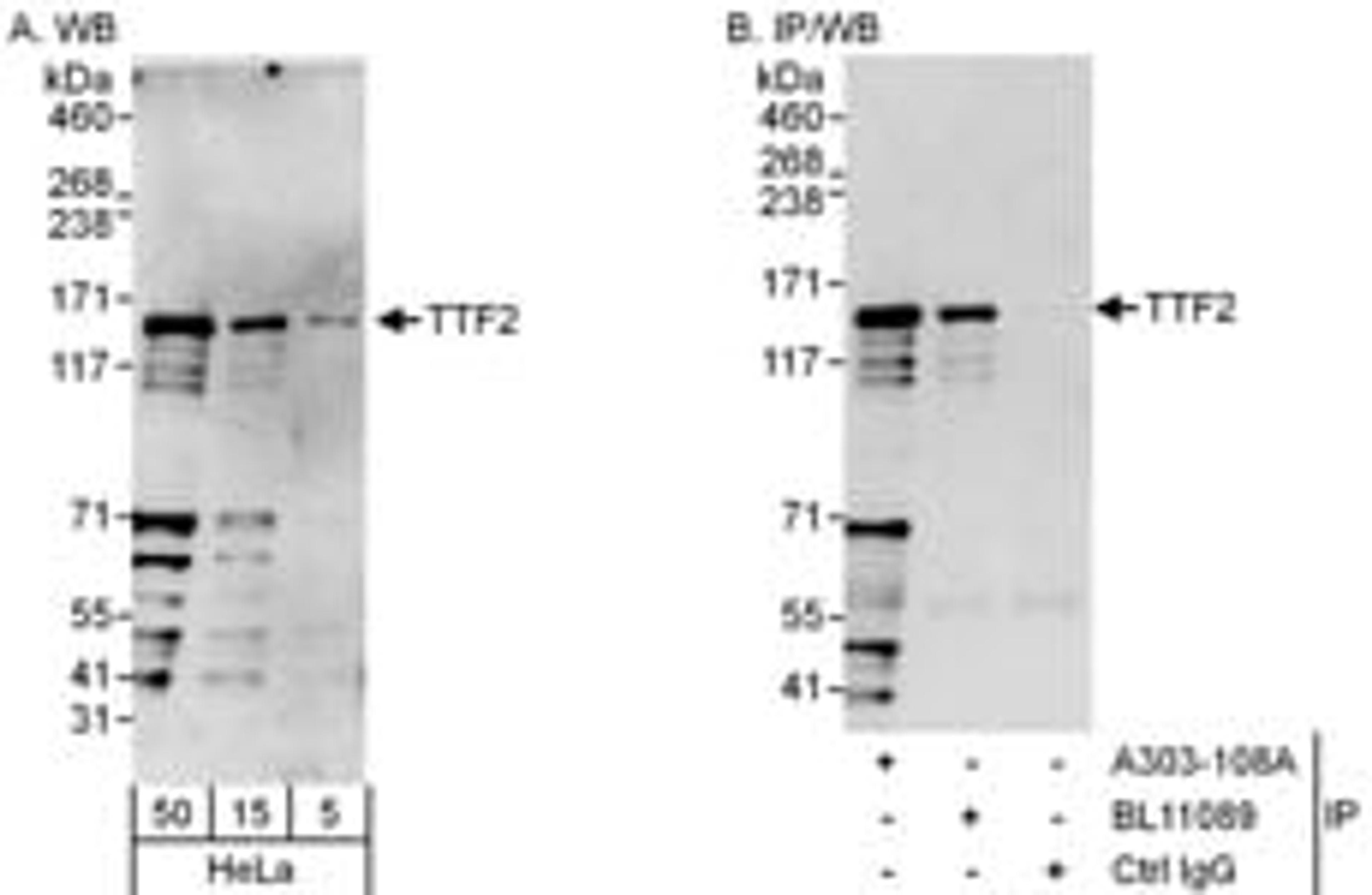 Detection of human TTF2 by western blot and immunoprecipitation.