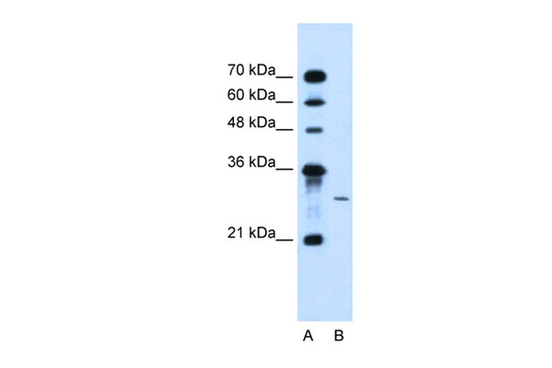 Antibody used in WB on Human Jurkat 5.0 ug/ml.