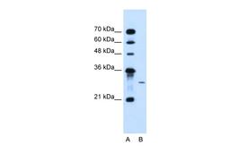 Antibody used in WB on Human Jurkat 5.0 ug/ml.