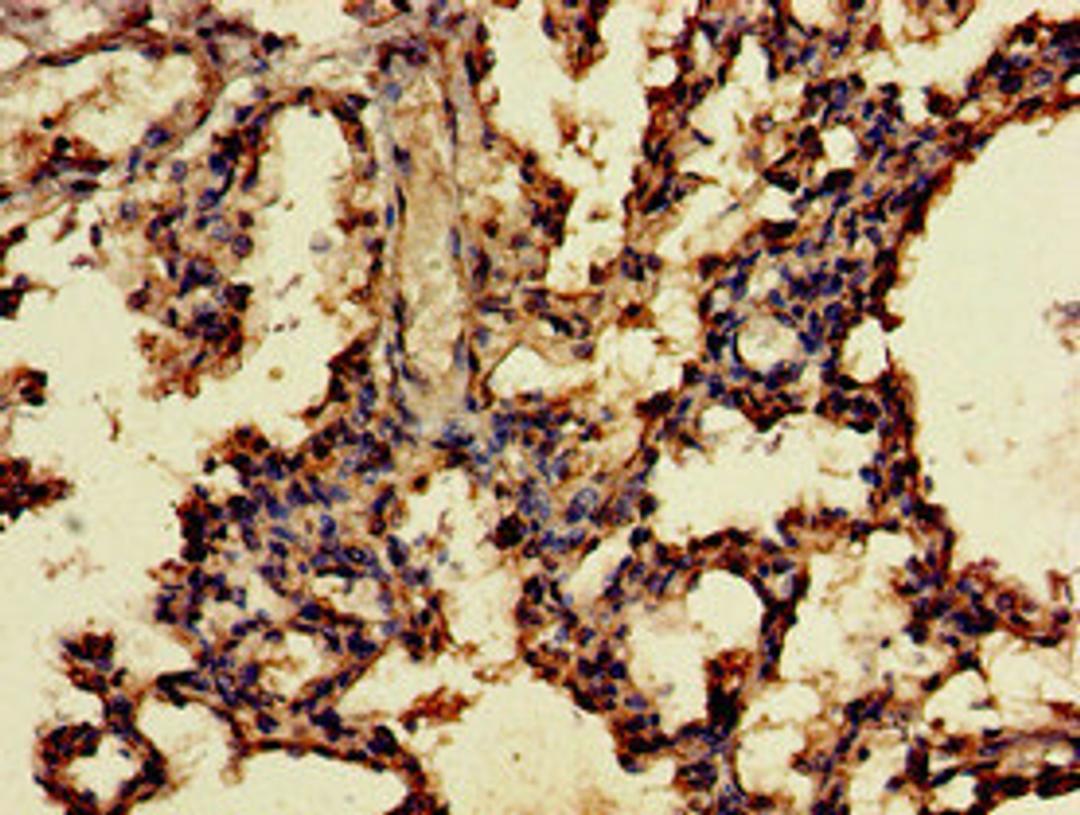 Immunohistochemistry of paraffin-embedded human lung tissue using CSB-PA758222LA01HU at dilution of 1:100
