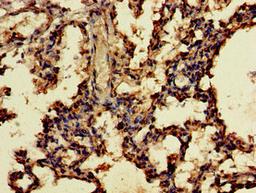Immunohistochemistry of paraffin-embedded human lung tissue using CSB-PA758222LA01HU at dilution of 1:100