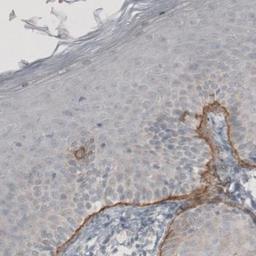 Immunohistochemistry: LAMC2 Antibody (CL2980) [NBP2-42388] - Staining of human skin shows strong immunoreactivity in basement membrane of squamous epithelium.