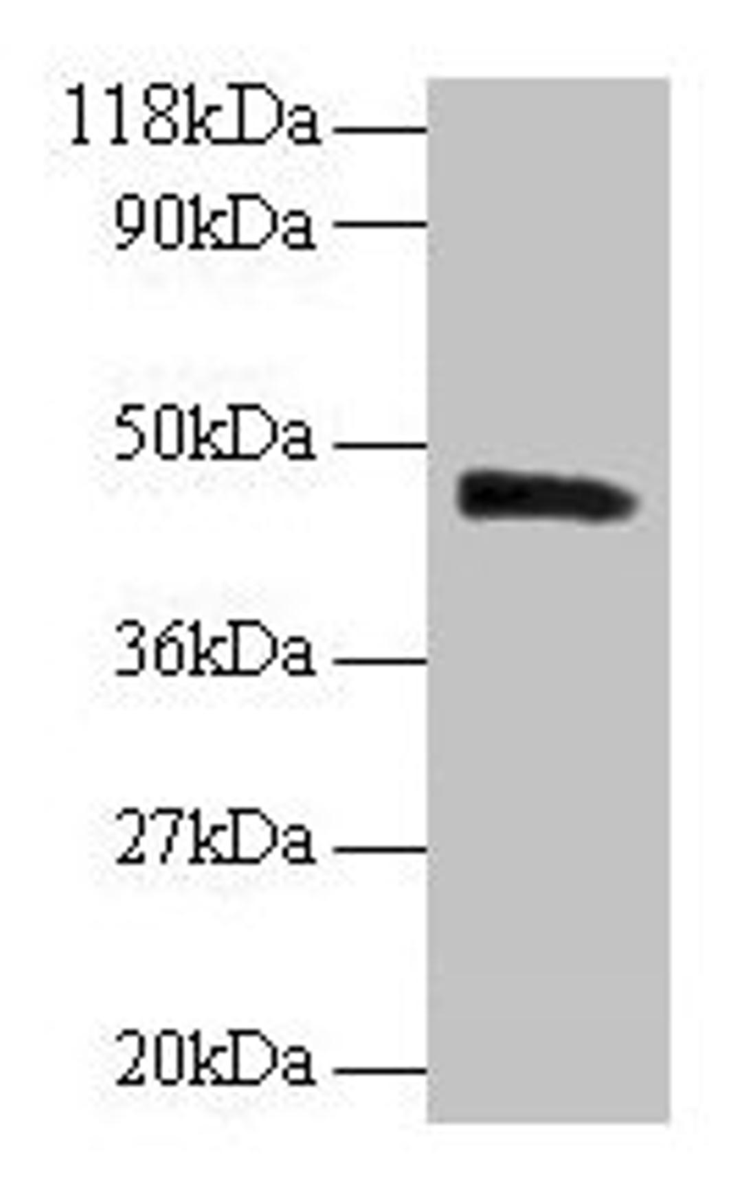 Western blot. All lanes: PICK1 antibody at 2µg/ml + Mouse brain tissue. Secondary. Goat polyclonal to rabbit IgG at 1/10000 dilution. Predicted band size: 47, 40 kDa. Observed band size: 47 kDa