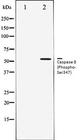 Western blot analysis of Jurkat whole cell lysates using Caspase 8 (Phospho-Ser347) antibody, The lane on the left is treated with the antigen-specific peptide.