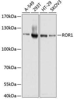 Western blot - ROR1 antibody (A3315)
