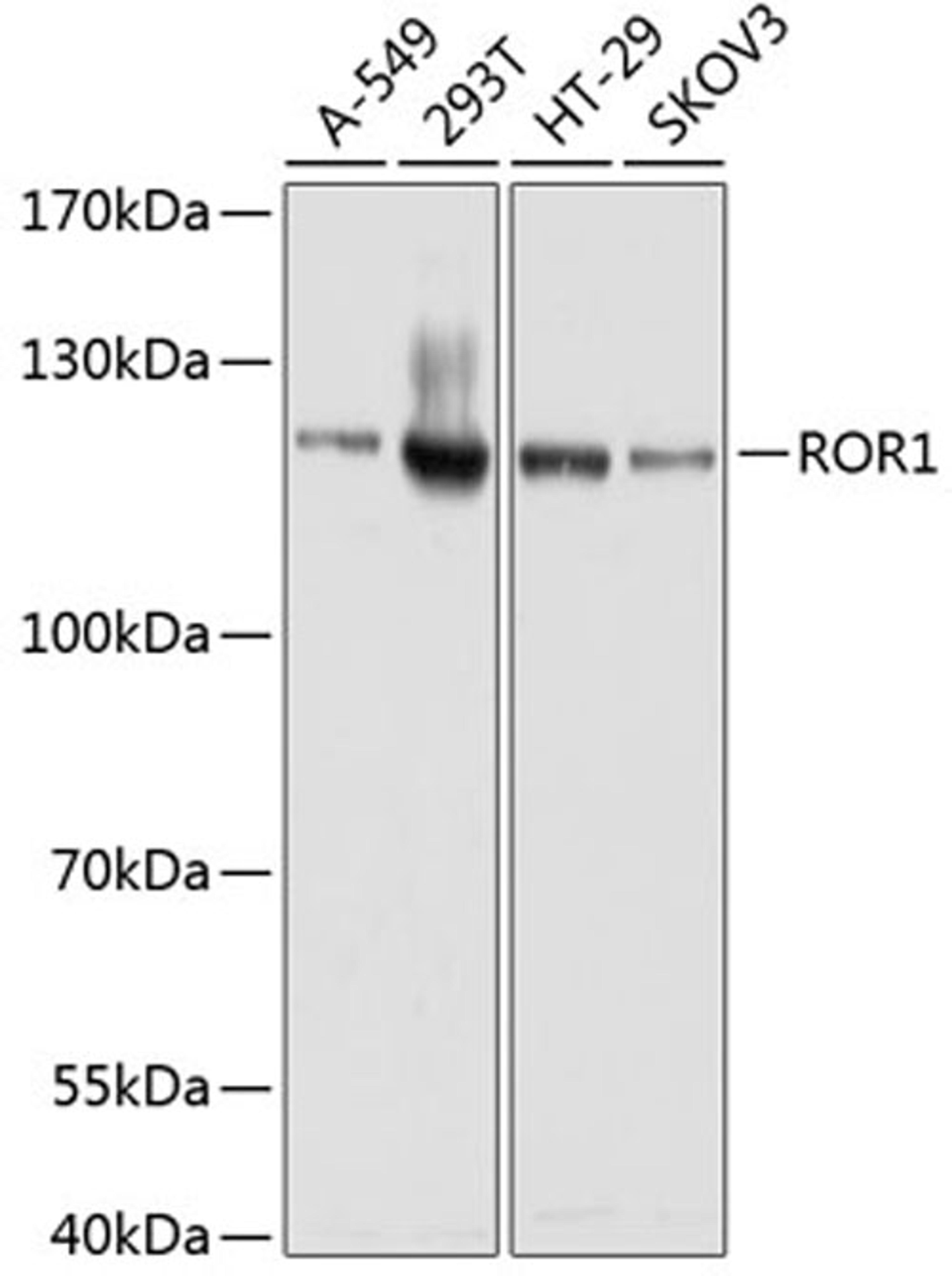 Western blot - ROR1 antibody (A3315)