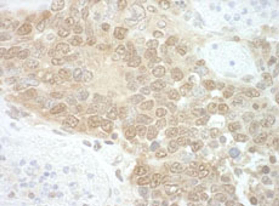 Detection of mouse RuvBL2 by immunohistochemistry.