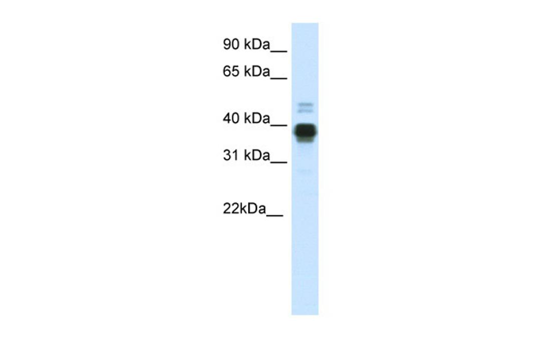 Antibody used in WB on Human Uterus at 0.2-1 ug/ml.