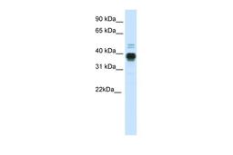 Antibody used in WB on Human Uterus at 0.2-1 ug/ml.