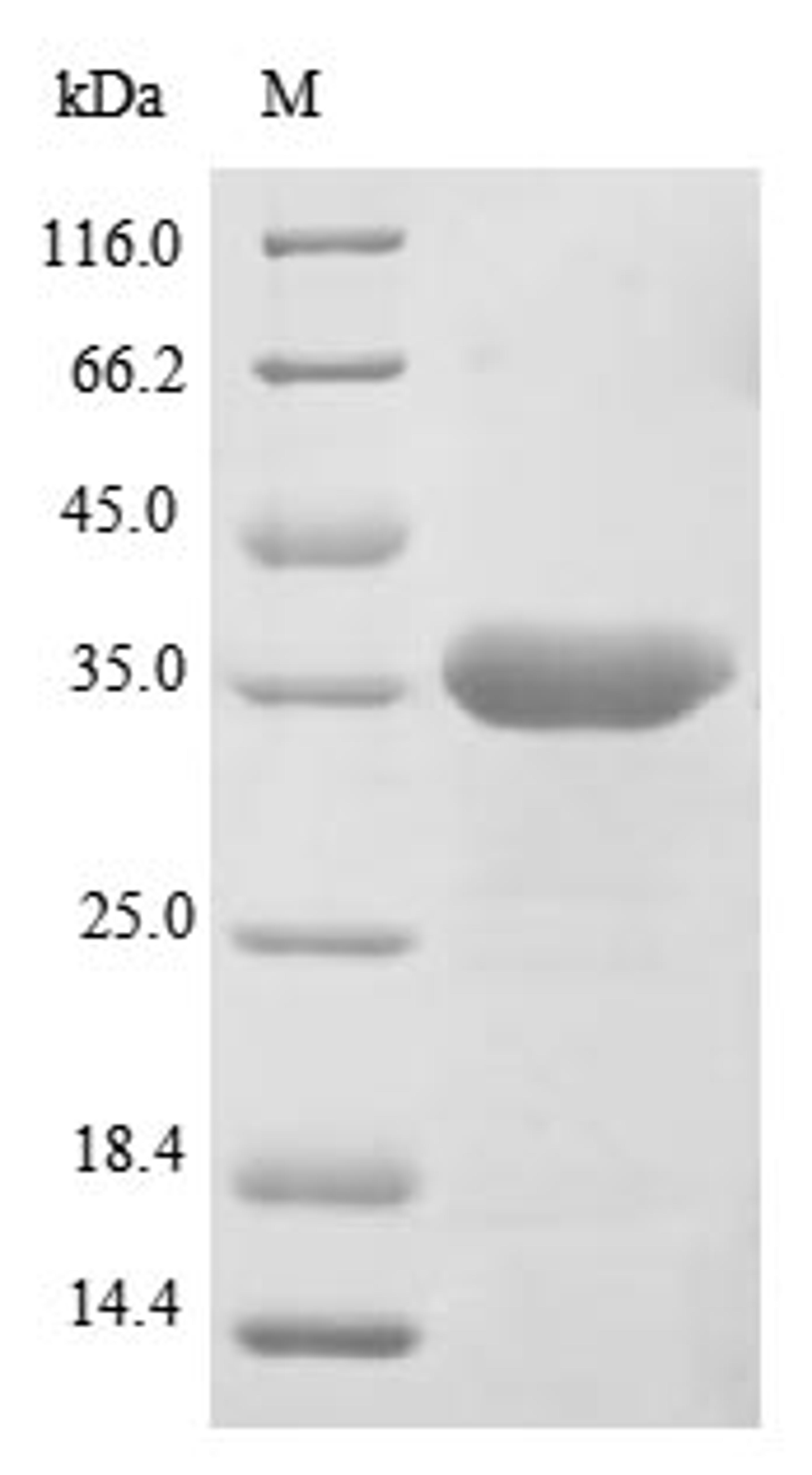 (Tris-Glycine gel) Discontinuous SDS-PAGE (reduced) with 5% enrichment gel and 15% separation gel.
