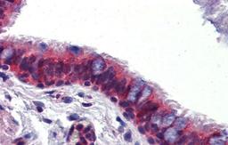 Immunohistochemistry-Paraffin: Crossveinless-2/CV-2/BMPER Antibody [NBP1-58041] - Human Lung, respiratory epethelium, 5.0ug/ml.