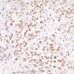 Detection of human NUCKS by immunohistochemistry.