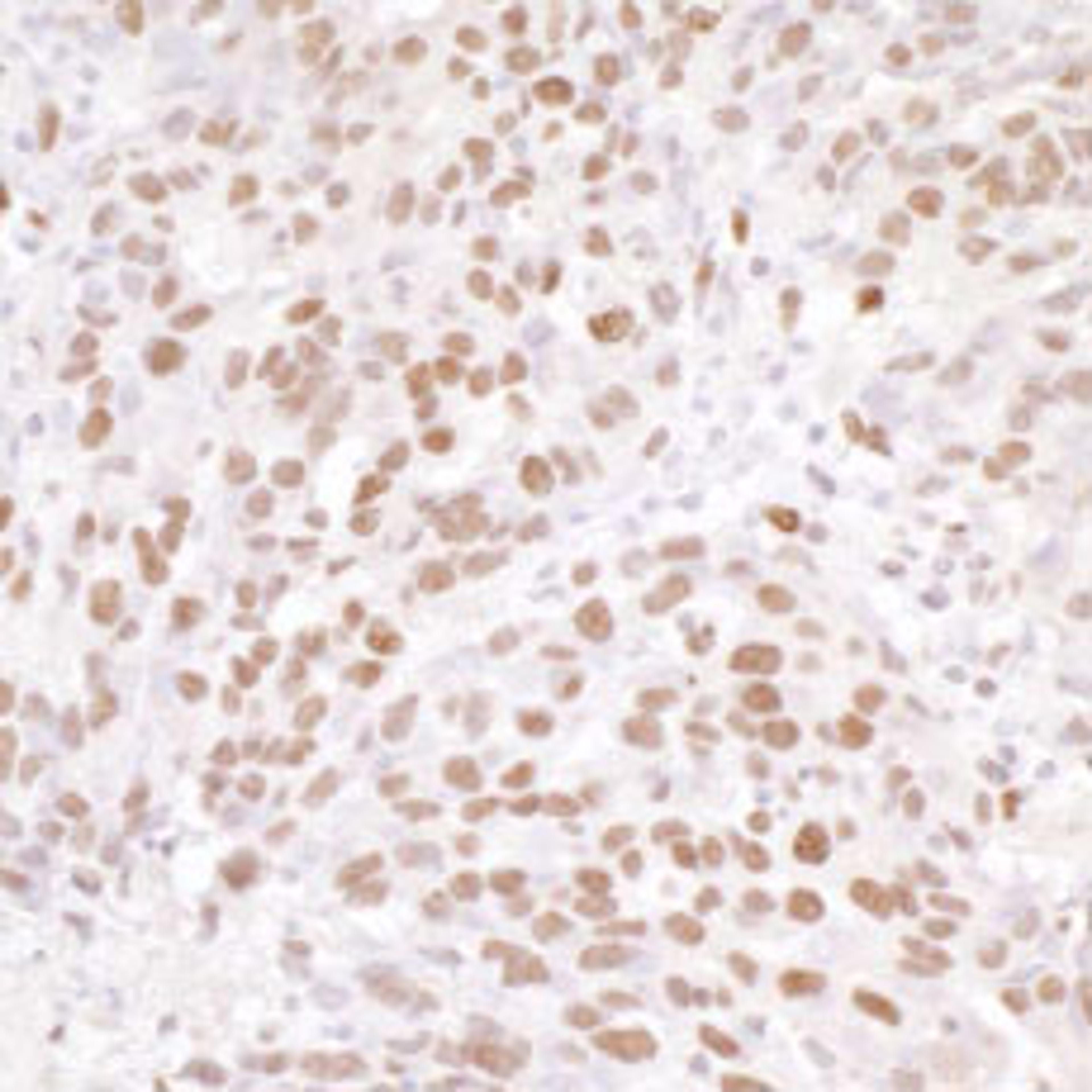 Detection of human NUCKS by immunohistochemistry.