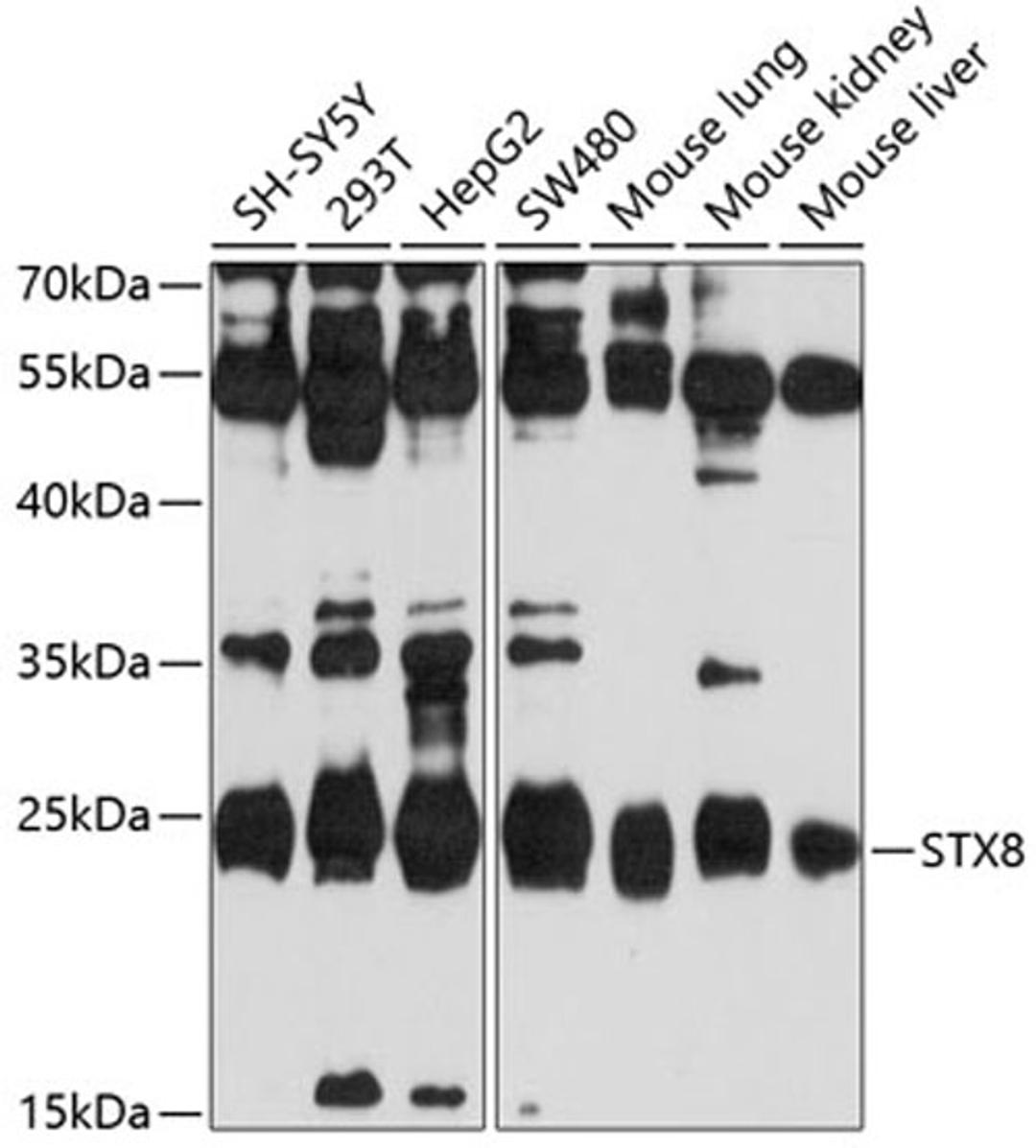 Western blot - STX8 antibody (A10050)