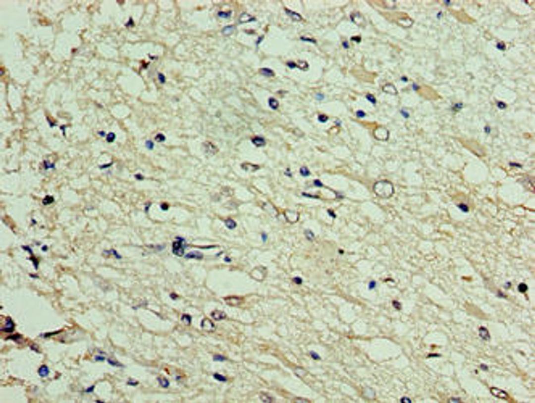 Immunohistochemistry of paraffin-embedded human brain tissue using CSB-PA846659HA01HU at dilution of 1:100