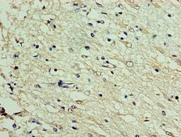Immunohistochemistry of paraffin-embedded human brain tissue using CSB-PA846659HA01HU at dilution of 1:100