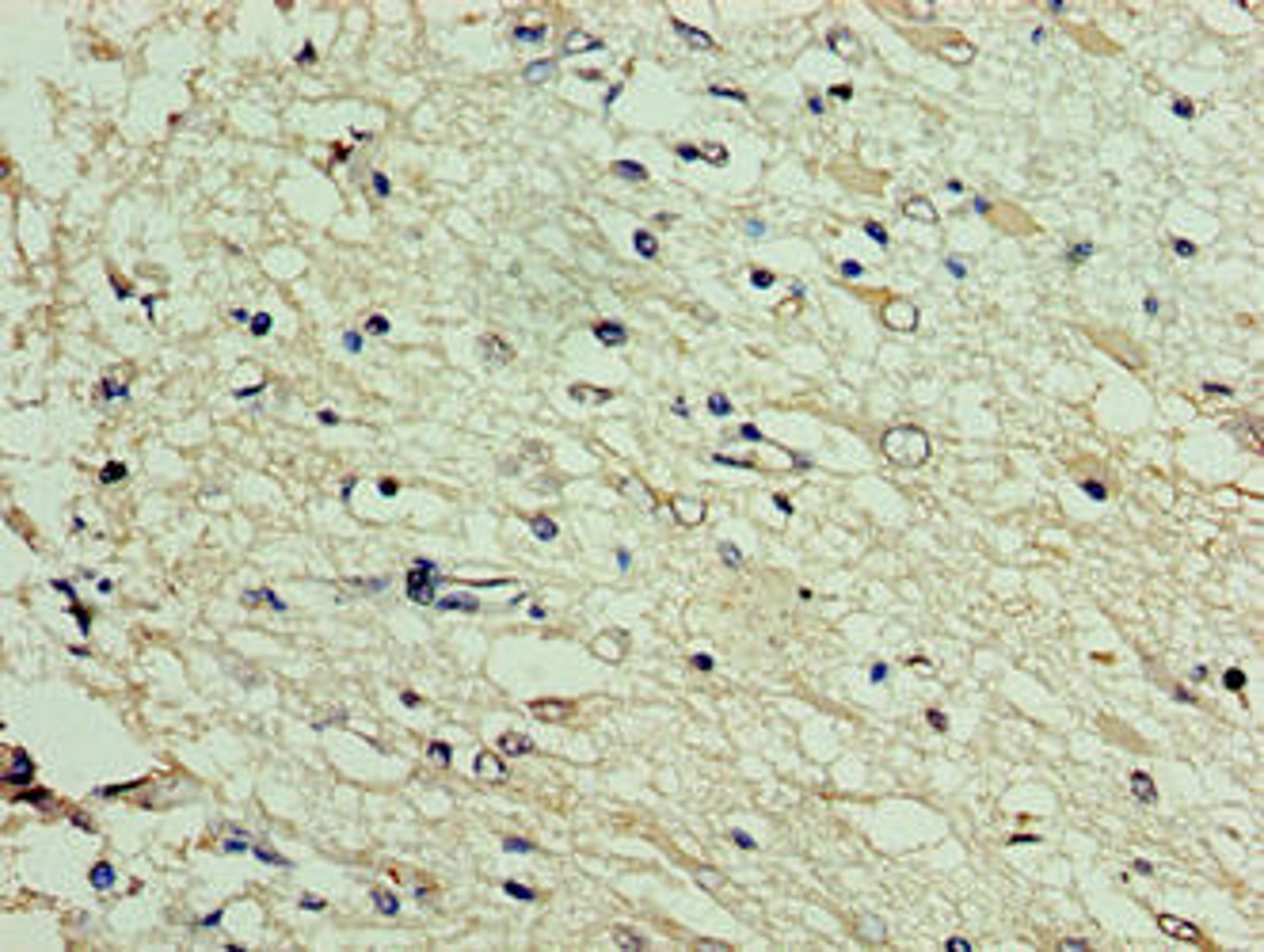 Immunohistochemistry of paraffin-embedded human brain tissue using CSB-PA846659HA01HU at dilution of 1:100