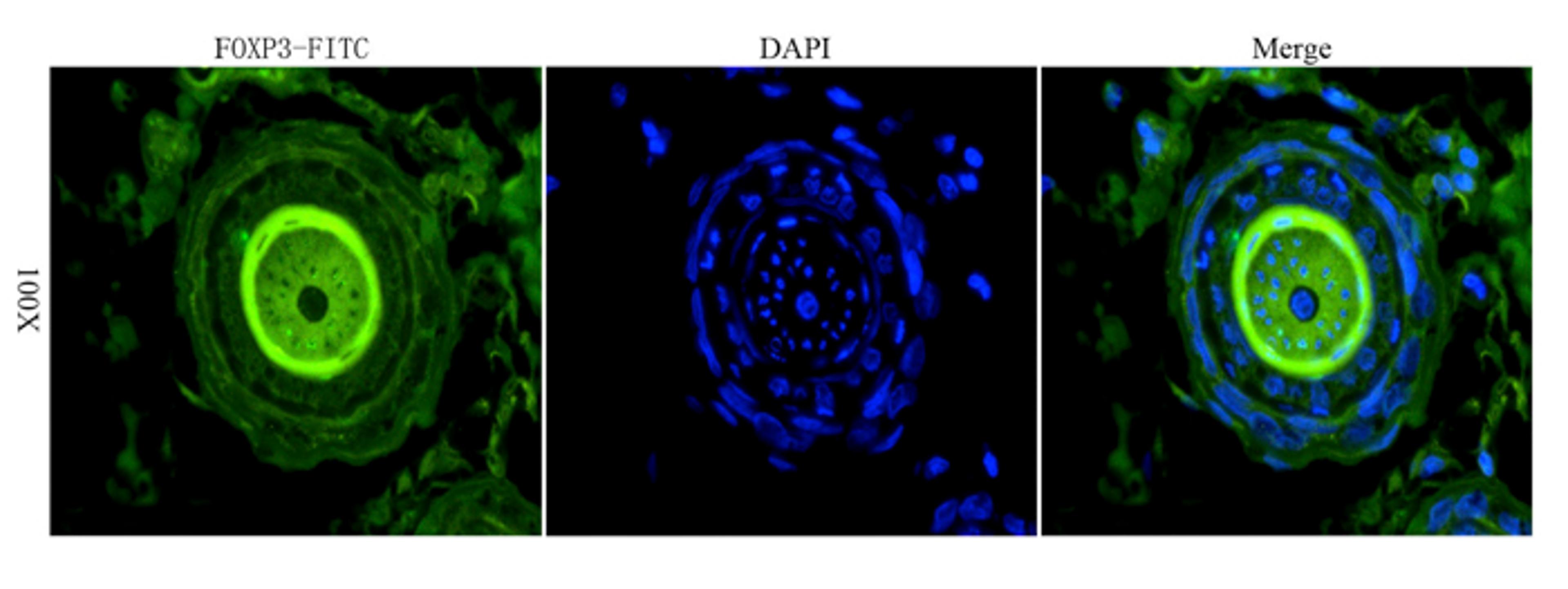 Immunofluorescence analysis of rat skin tissue using anti-FOXP3 (dilution of primary antibody - 1:100)