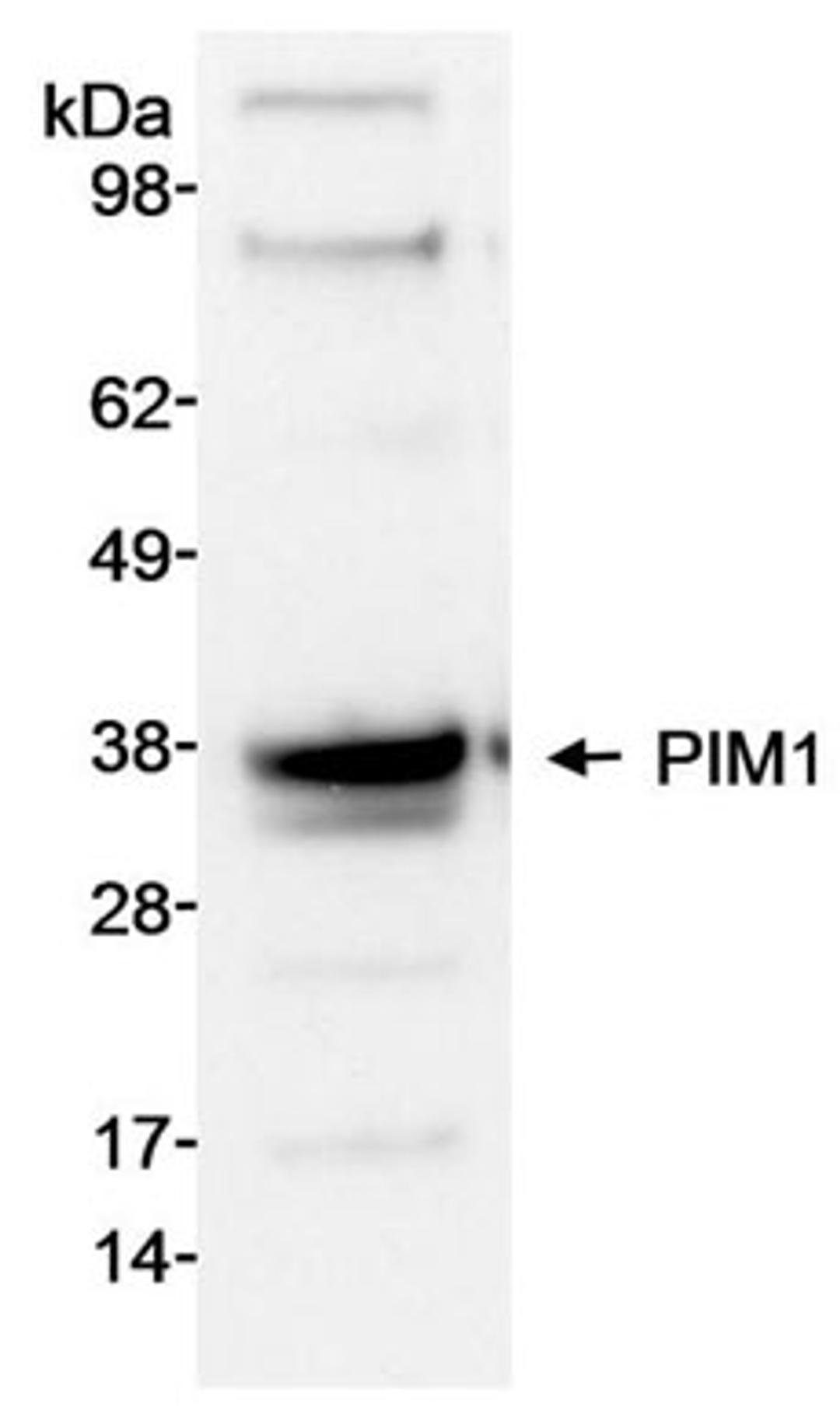 Detection of human PIM1 by western blot.