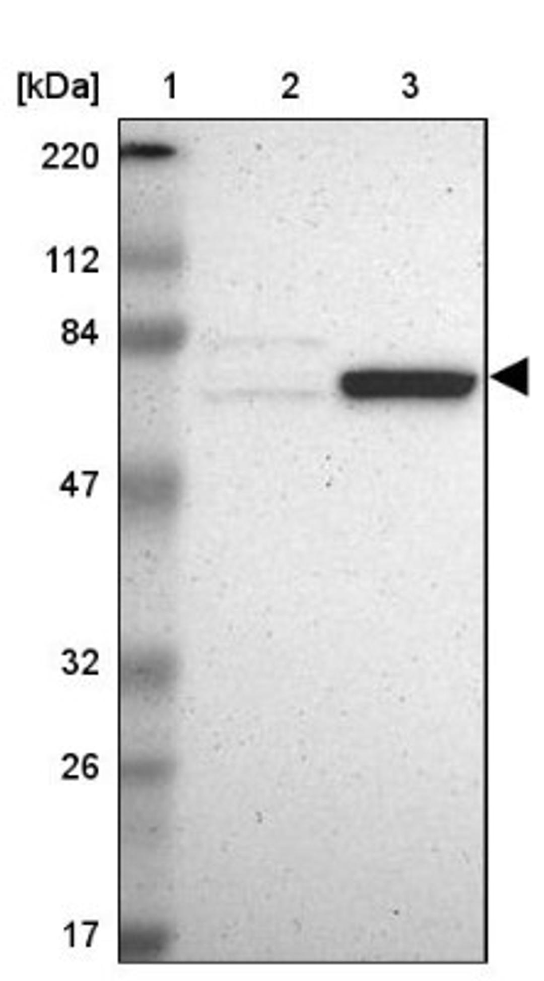 Western Blot: GRHL1 Antibody [NBP1-81321] - Lane 1: Marker [kDa] 220, 112, 84, 47, 32, 26, 17<br/>Lane 2: Human cell line RT-4<br/>Lane 3: Human cell line U-251MG sp