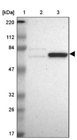 Western Blot: GRHL1 Antibody [NBP1-81321] - Lane 1: Marker [kDa] 220, 112, 84, 47, 32, 26, 17<br/>Lane 2: Human cell line RT-4<br/>Lane 3: Human cell line U-251MG sp