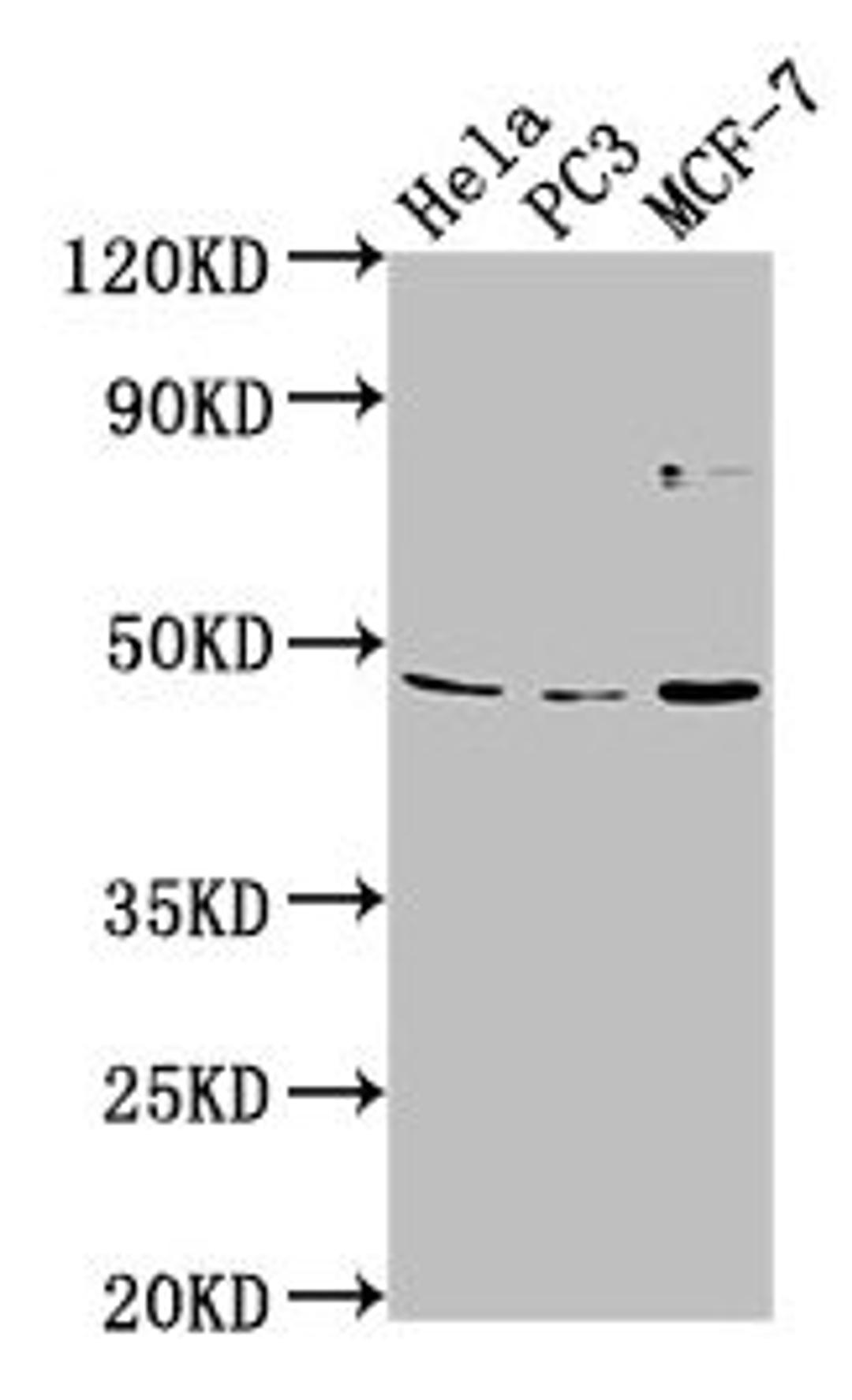Western Blot. Positive WB detected in: Hela whole cell lysate, PC-3 whole cell lysate, MCF-7 whole cell lysate. All lanes: TMEM237 antibody at 1:2000. Secondary. Goat polyclonal to rabbit IgG at 1/50000 dilution. Predicted band size: 46, 45, 49, 36, 47 kDa. Observed band size: 46 kDa
