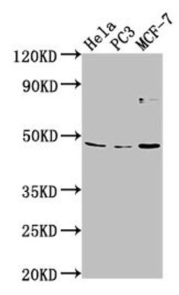 Western Blot. Positive WB detected in: Hela whole cell lysate, PC-3 whole cell lysate, MCF-7 whole cell lysate. All lanes: TMEM237 antibody at 1:2000. Secondary. Goat polyclonal to rabbit IgG at 1/50000 dilution. Predicted band size: 46, 45, 49, 36, 47 kDa. Observed band size: 46 kDa