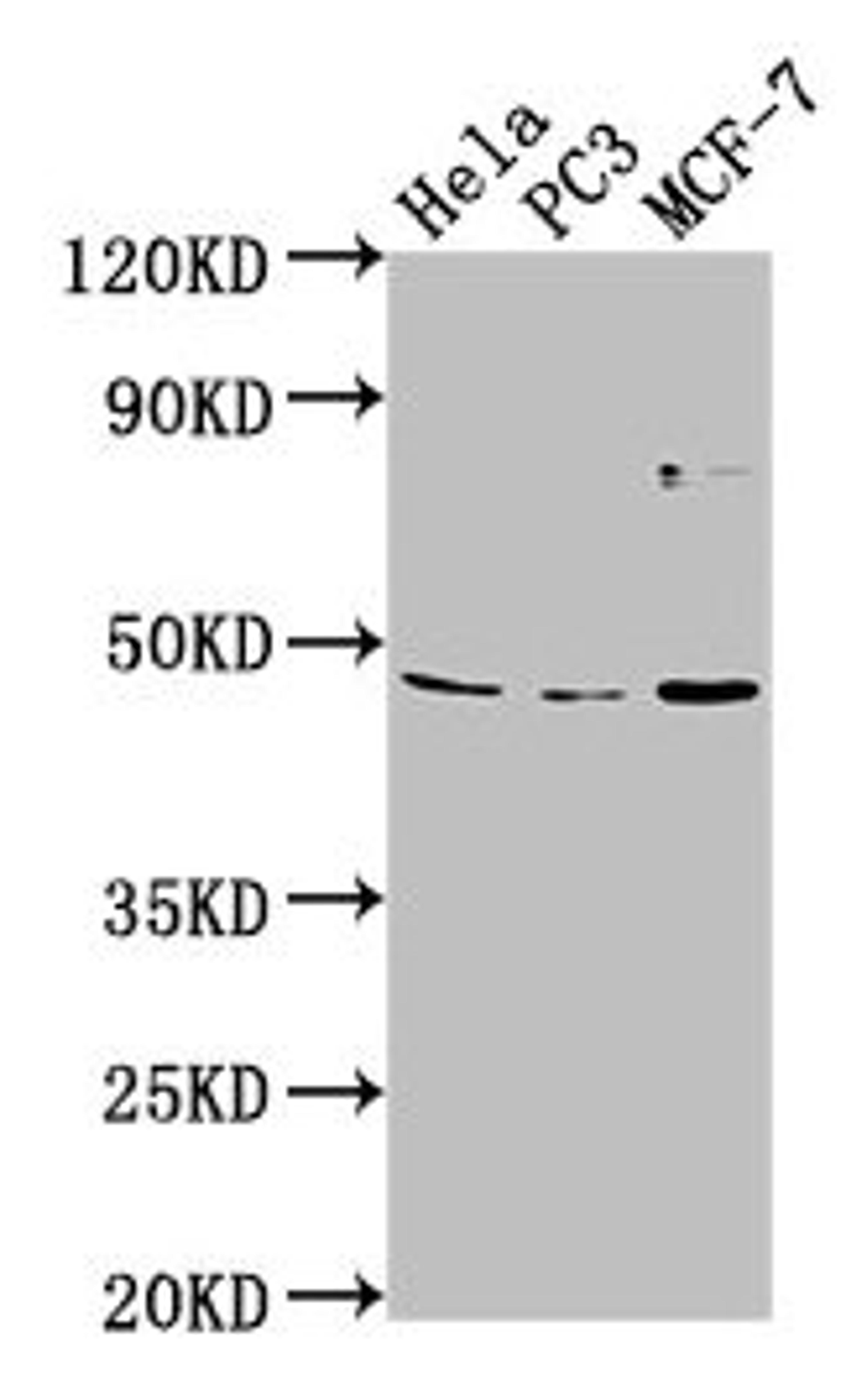 Western Blot. Positive WB detected in: Hela whole cell lysate, PC-3 whole cell lysate, MCF-7 whole cell lysate. All lanes: TMEM237 antibody at 1:2000. Secondary. Goat polyclonal to rabbit IgG at 1/50000 dilution. Predicted band size: 46, 45, 49, 36, 47 kDa. Observed band size: 46 kDa