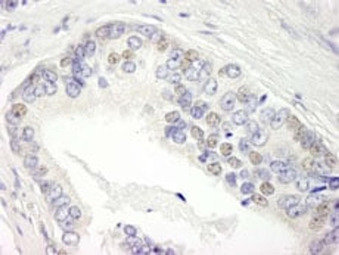 Detection of human BRD3 by immunohistochemistry.