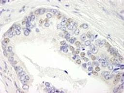 Detection of human BRD3 by immunohistochemistry.