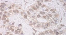 Detection of human RECQ5 by immunohistochemistry.